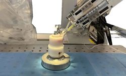 GÖZ CERRAHİSİNDE YENİ DÖNEM: 'ROBOT TEKNOLOJİSİ'