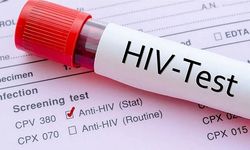 KOCAELİ'DE KİMLİK BİLGİSİ İSTENMEDEN ÜCRETSİZ HIV TESTİ