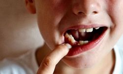 SOSYAL MEDYA ÖNERİLERİ ÇOCUKLARIN DİŞ SAĞLIĞINI RİSKE ATMASIN