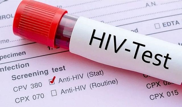 KOCAELİ'DE KİMLİK BİLGİSİ İSTENMEDEN ÜCRETSİZ HIV TESTİ