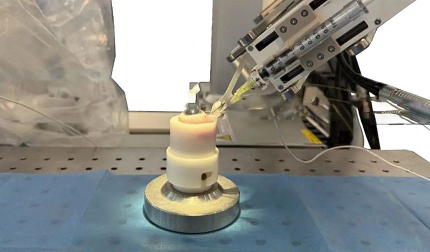 GÖZ CERRAHİSİNDE YENİ DÖNEM: 'ROBOT TEKNOLOJİSİ'