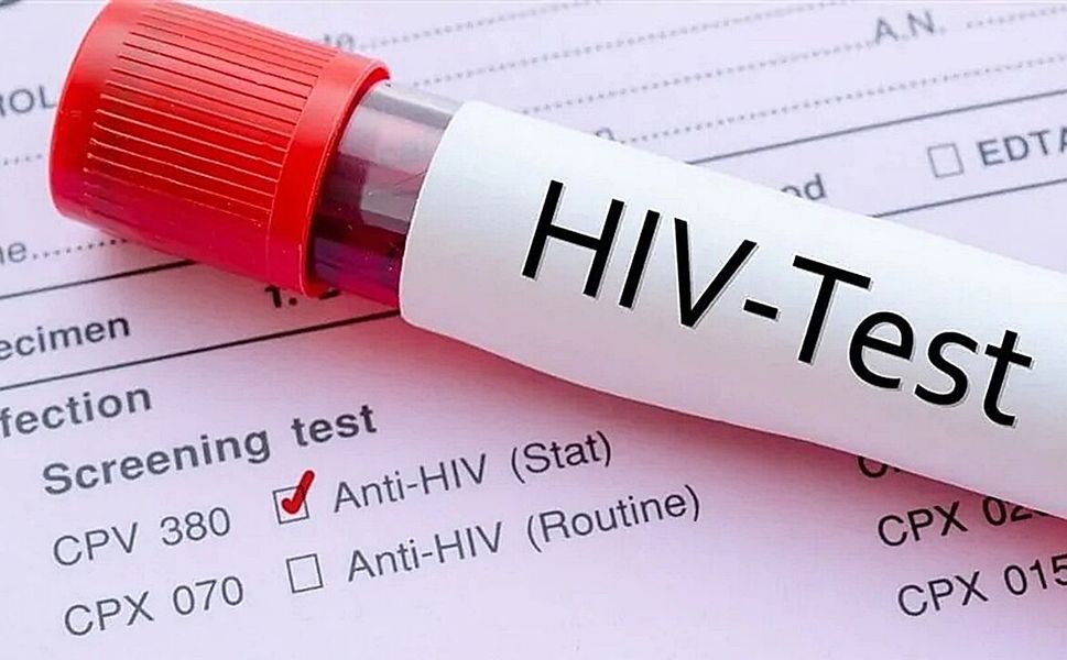KOCAELİ'DE KİMLİK BİLGİSİ İSTENMEDEN ÜCRETSİZ HIV TESTİ