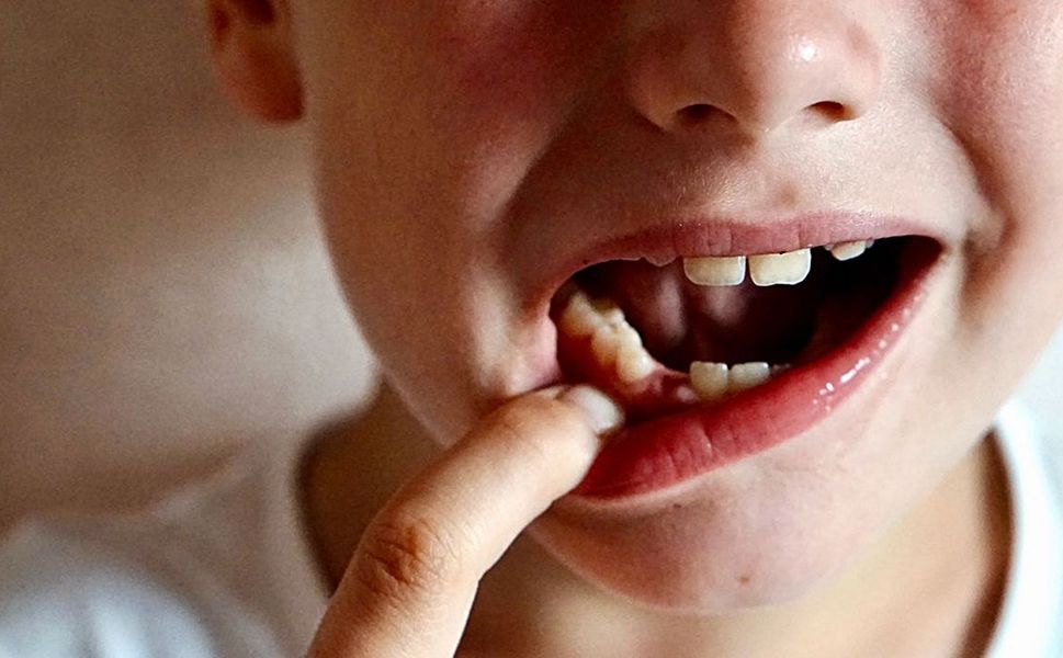 SOSYAL MEDYA ÖNERİLERİ ÇOCUKLARIN DİŞ SAĞLIĞINI RİSKE ATMASIN